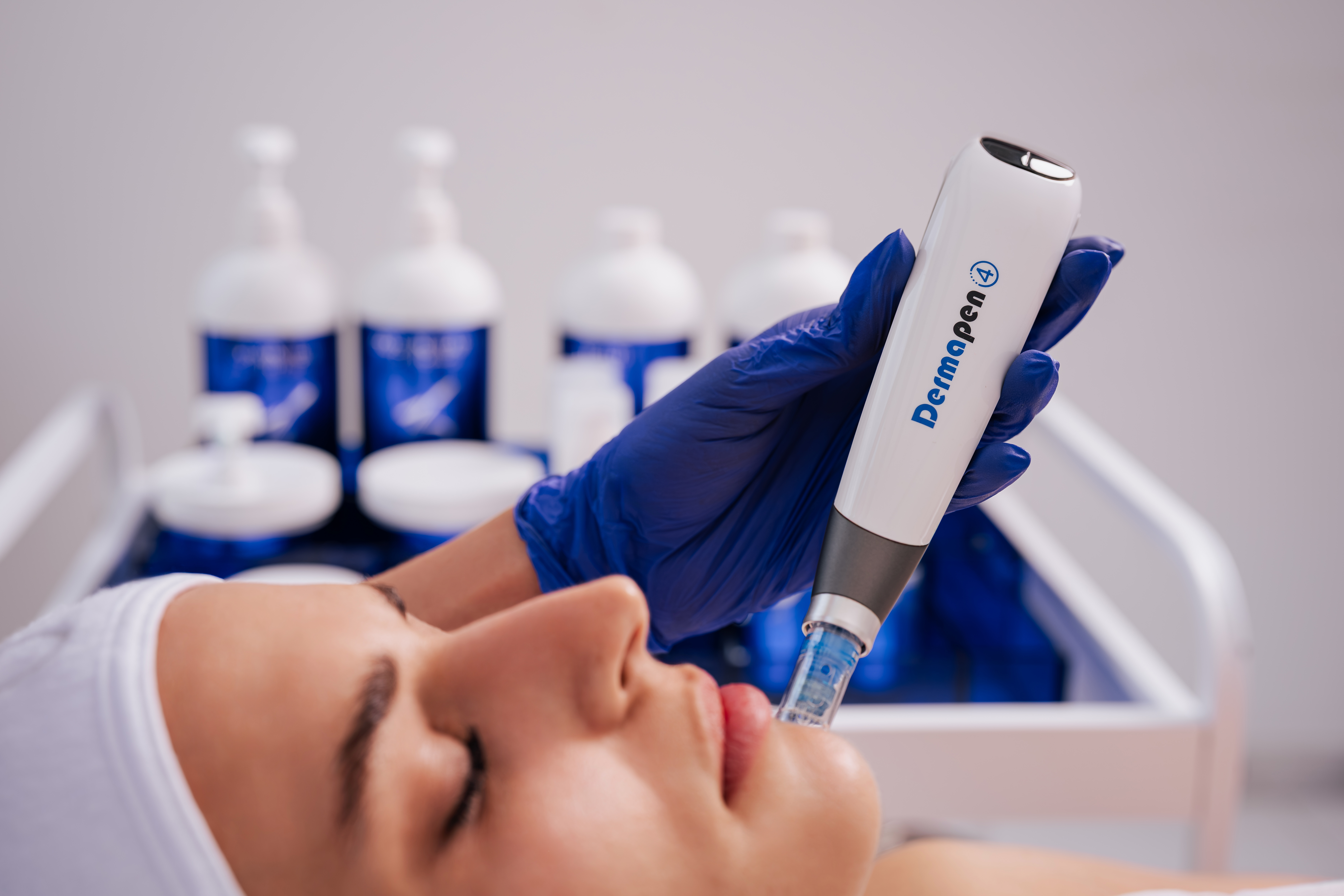 Microneedling