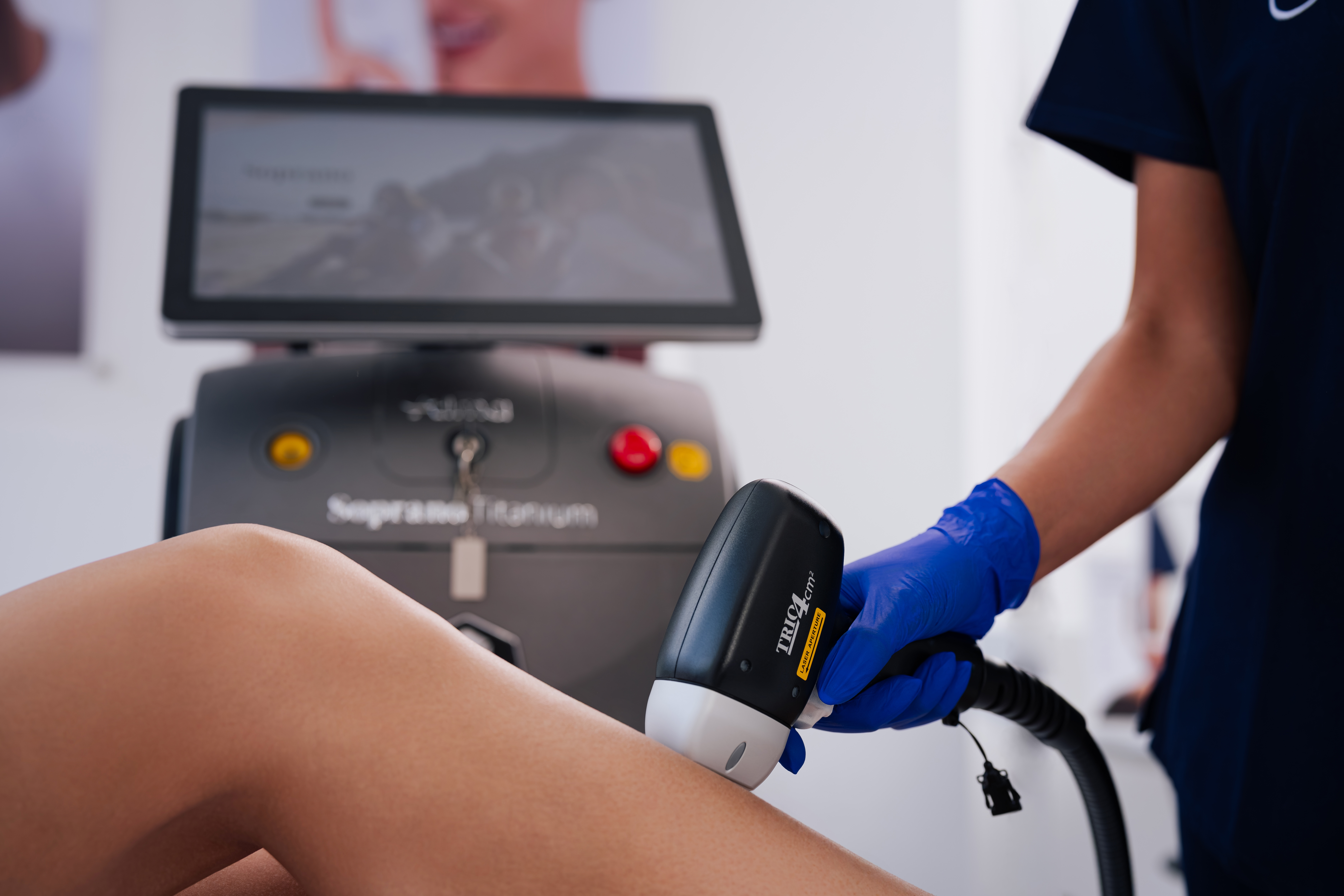 Laser Hair Removal
