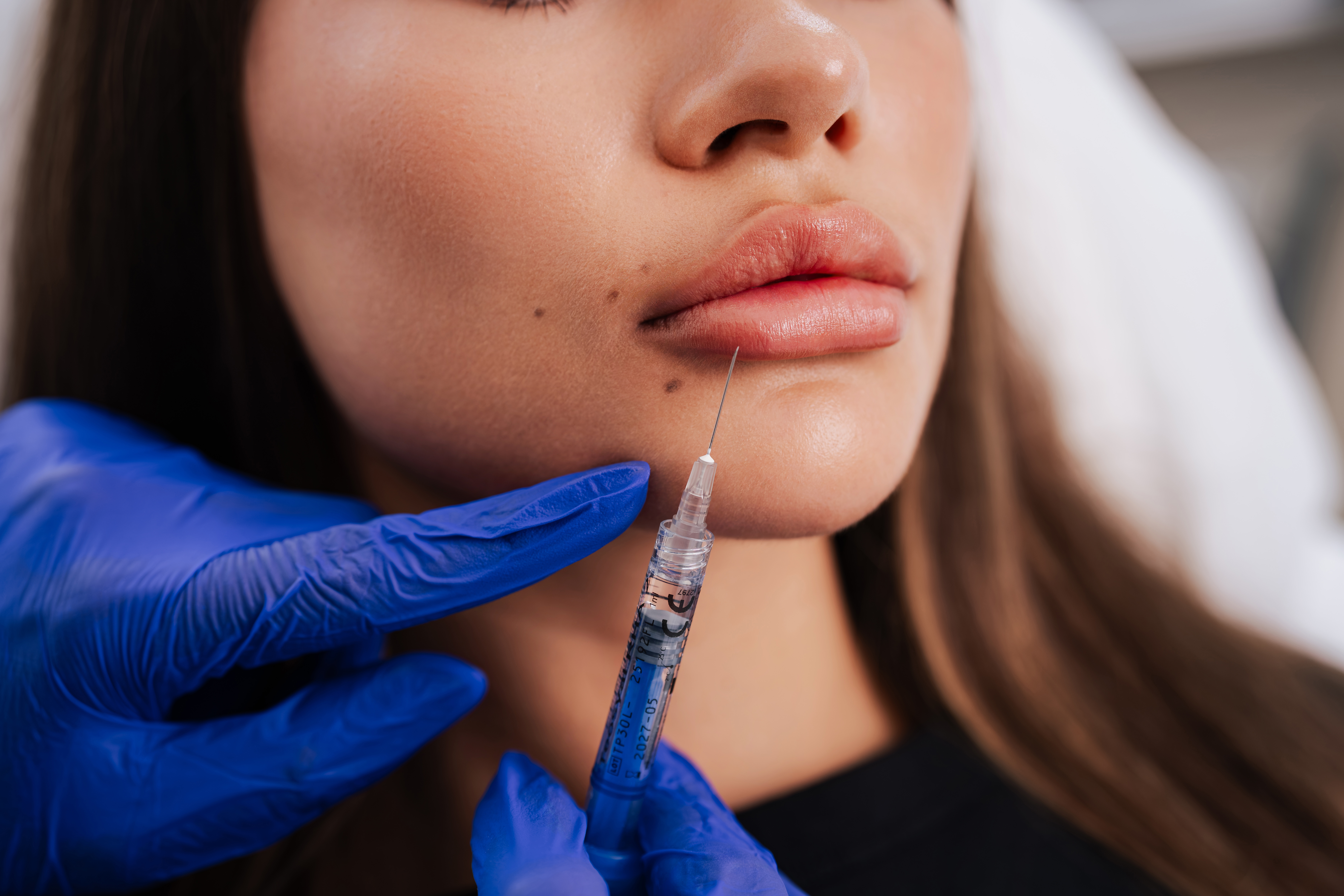 Dermal Fillers