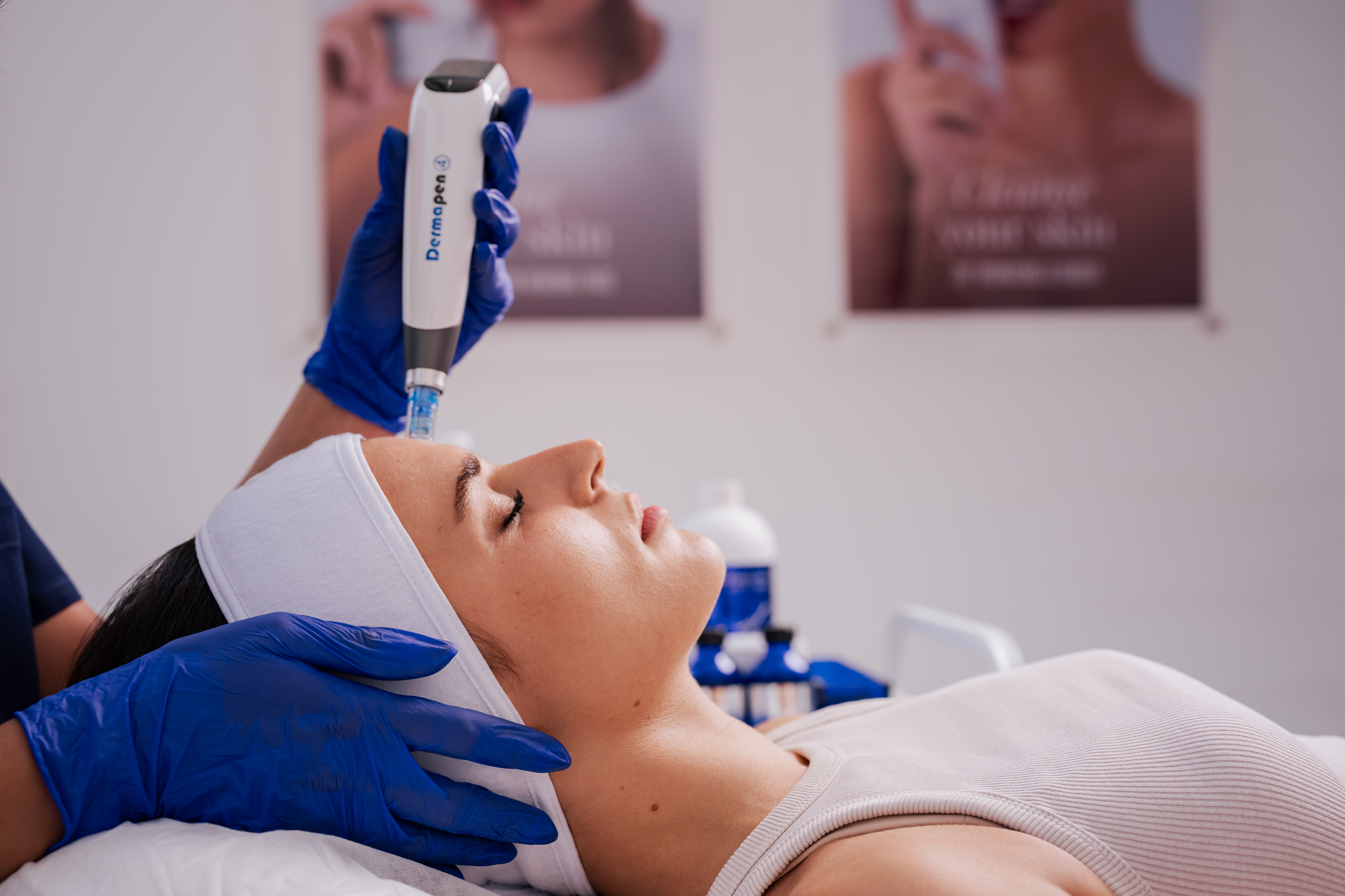 Microneedling