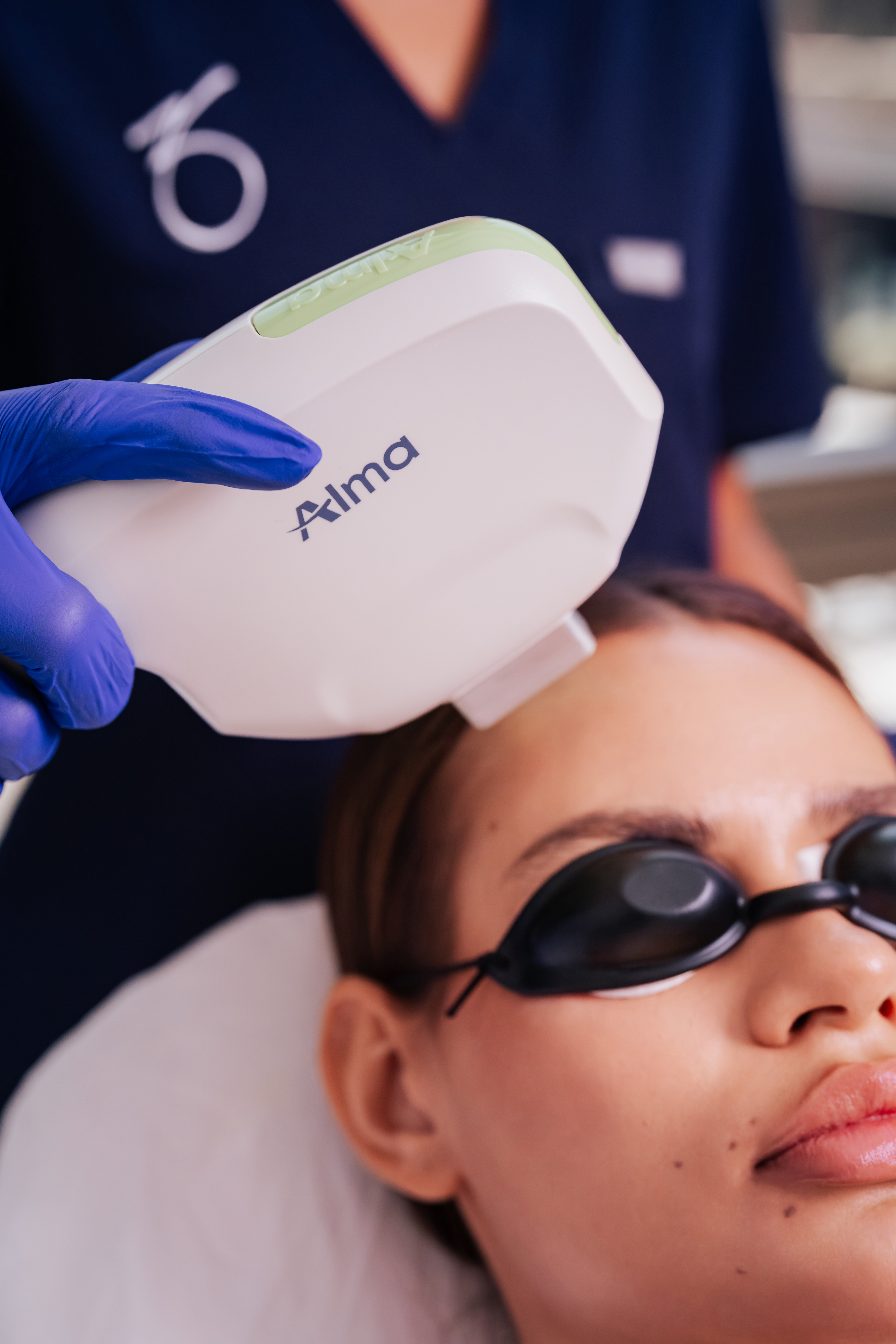 Dye VL Pro Photofacial