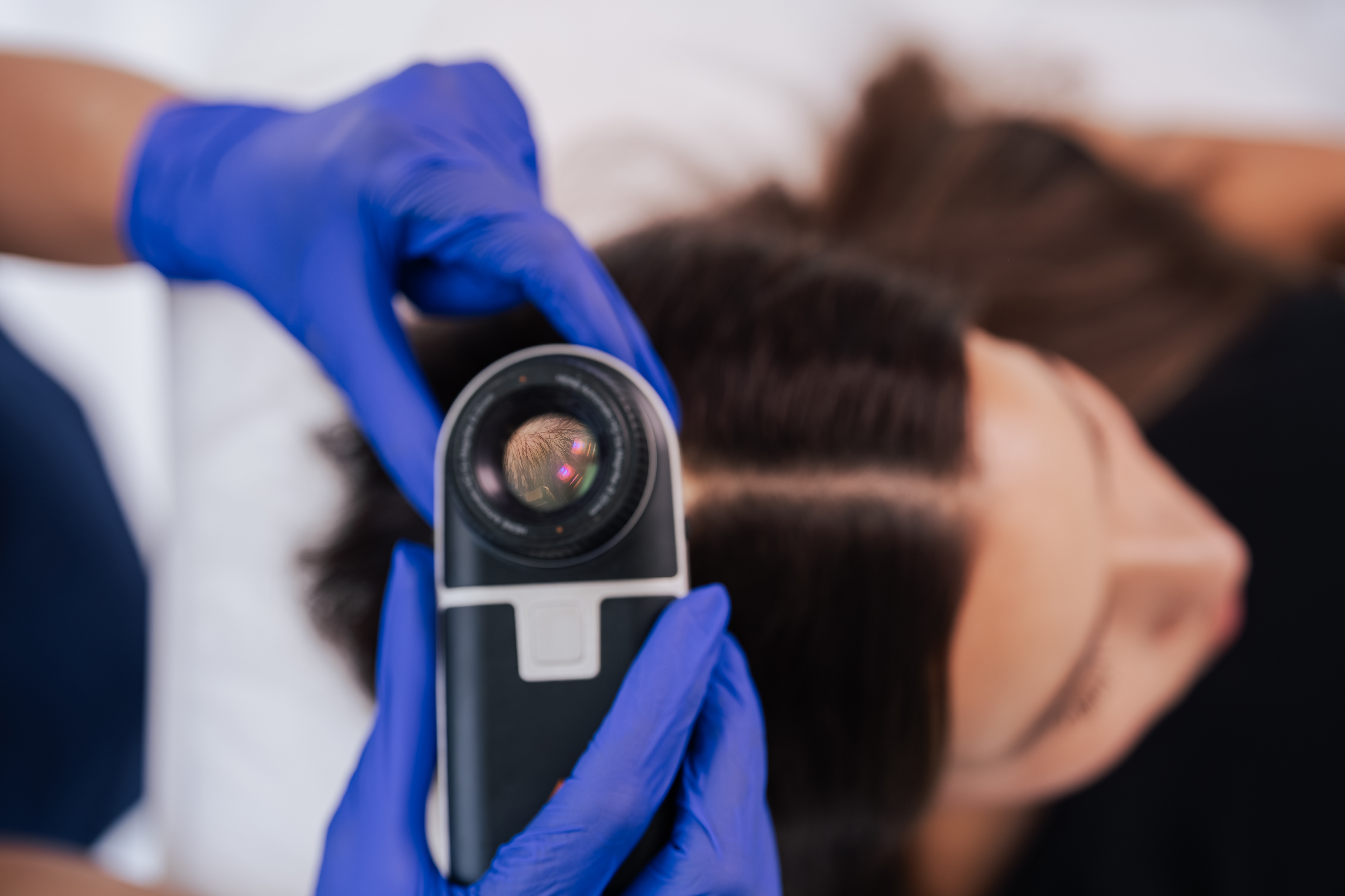 Hair Growth Factors