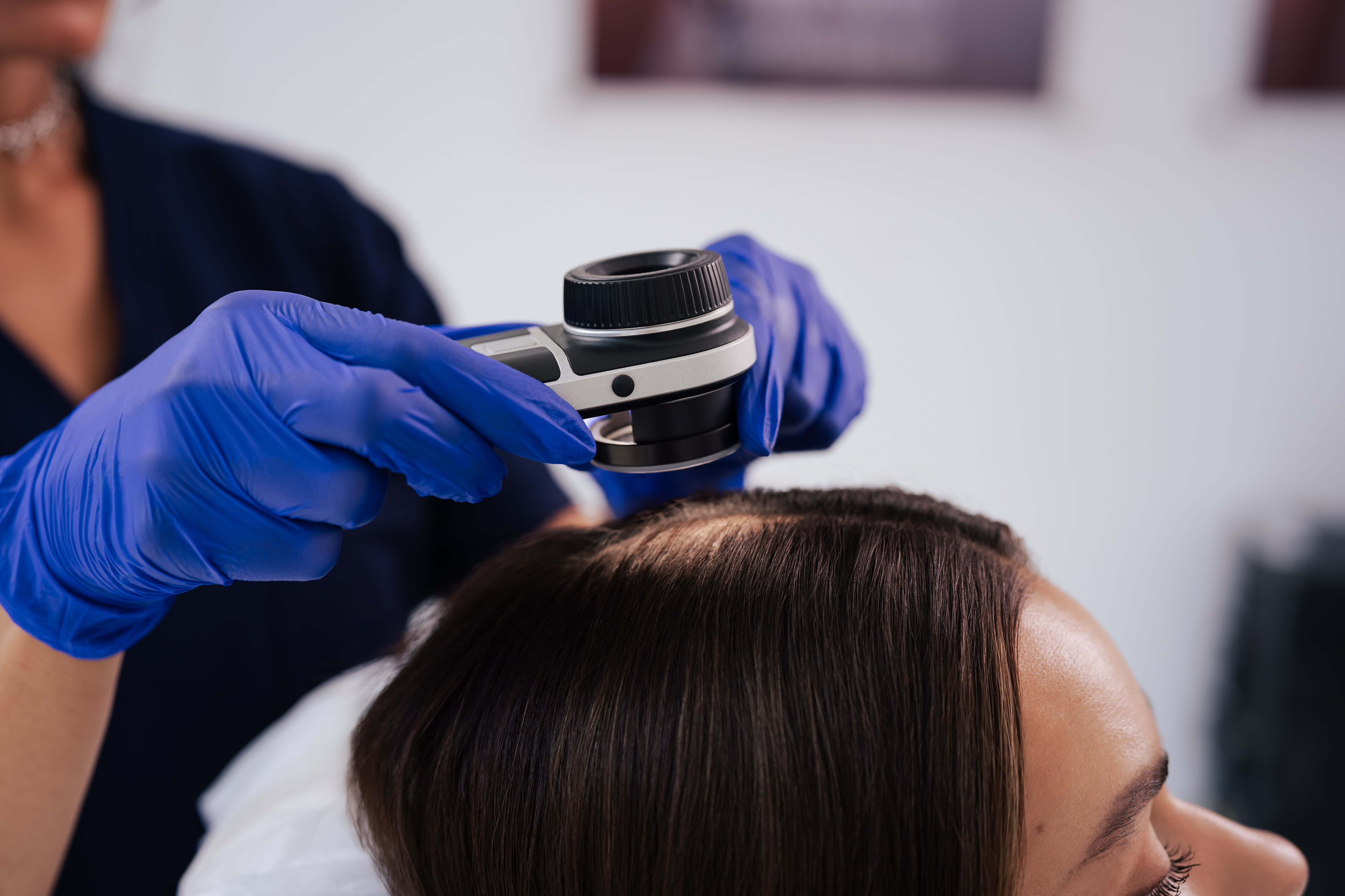 Hair Mesotherapy