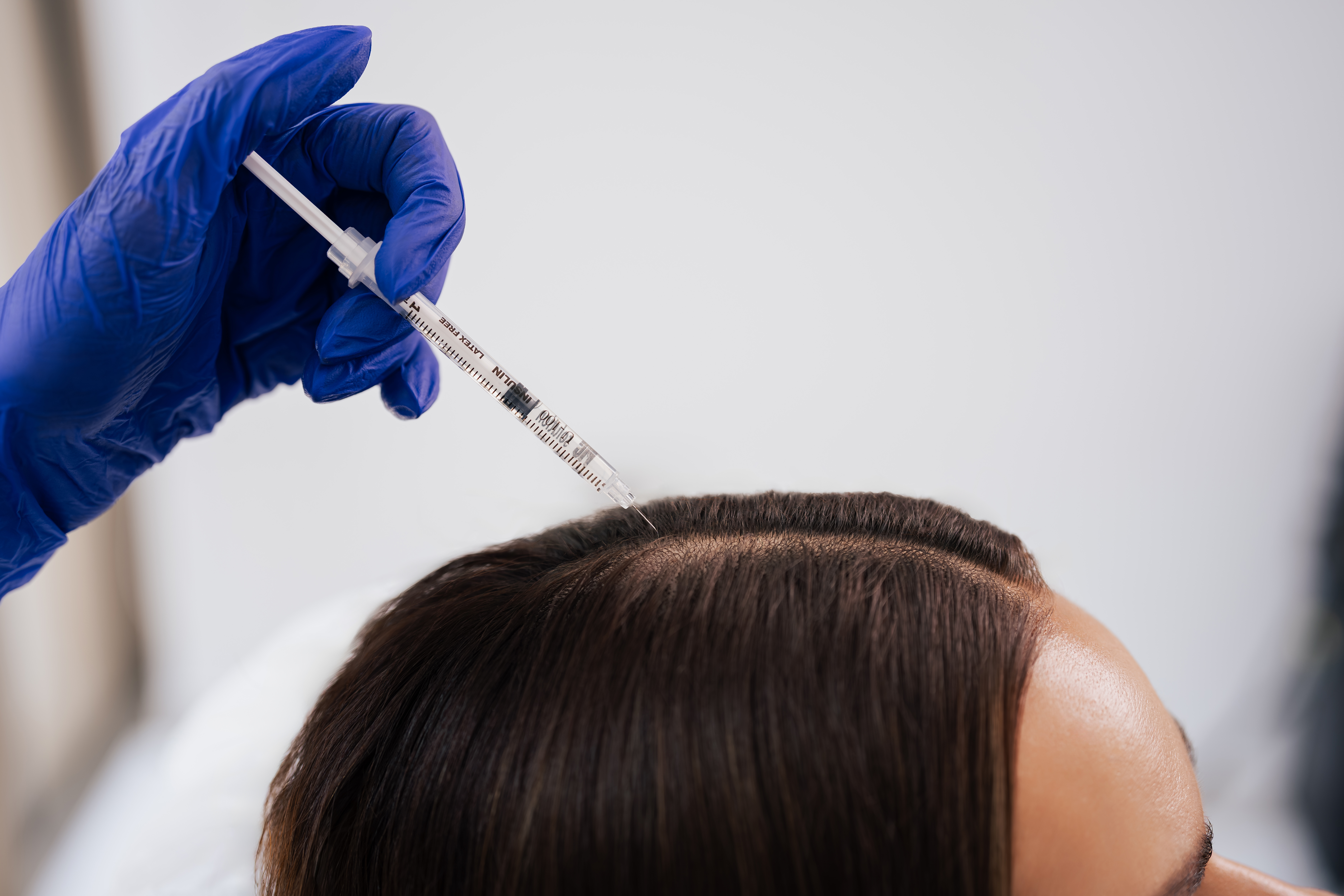Hair Exosomes
